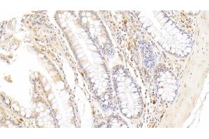 Detection of RNASE2 in Human Colon Tissue using Monoclonal Antibody to Ribonuclease A2 (RNASE2) (RNASE2 Antikörper  (AA 28-161))