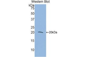 Western Blotting (WB) image for anti-Myosin Regulatory Light Chain 2, Smooth Muscle Isoform (MYL9) (AA 5-163) antibody (ABIN1859945)