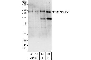 anti-DENN/MADD Domain Containing 4A (DENND4A) (AA 1525-1575) antibody