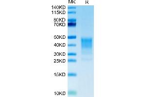 TNFSF8 Protein (AA 63-234) (His tag)