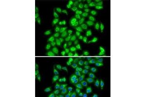 Immunofluorescence analysis of MCF7 cells using COPS3 Polyclonal Antibody (COPS3 Antikörper)