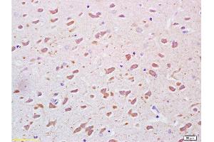 Immunohistochemistry (Paraffin-embedded Sections) (IHC (p)) image for anti-serpin Peptidase Inhibitor, Clade F (Alpha-2 Antiplasmin, Pigment Epithelium Derived Factor), Member 1 (SERPINF1) (AA 201-300) antibody (ABIN672456)
