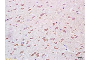 Formalin-fixed and paraffin embedded rat brain tissue labeled Anti-PEGF Polyclonal Antibody, Unconjugated  at 1:200, followed by conjugation to the secondary antibody and DAB staining
