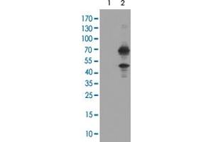 Western Blot analysis of HEK293T cells (Lane 1: transfected with pCMV6-ENTRY control and Lane 2: transfected with pCMV6-ENTRY TRMT2A cDNA) with TRMT2A monoclonal antibody, clone 1G8 . (TRMT2A Antikörper)