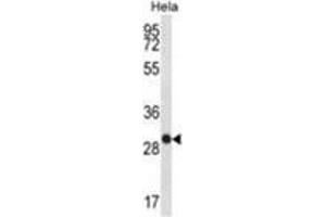 Western Blotting (WB) image for anti-WAP Four-Disulfide Core Domain 1 (WFDC1) (AA 147-177), (C-Term), (His163) antibody (ABIN955571)