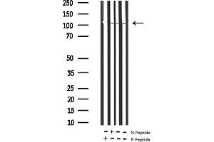 Western blot analysis of Phospho-PDGFR beta (Tyr1021) Antibody expression in Rat kidney and mouse kidney tissues lysates.