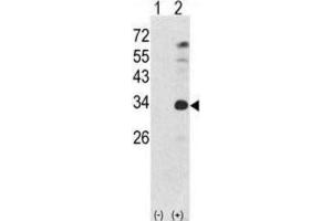 Western Blotting (WB) image for anti-Nanog Homeobox (NANOG) antibody (ABIN2998310) (Nanog Antikörper)