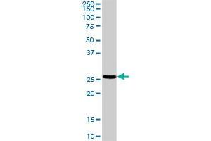 TNNI2 MaxPab rabbit polyclonal antibody. (TNNI2 Antikörper  (AA 1-182))