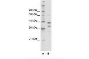 Image no. 1 for anti-SWI/SNF Related, Matrix Associated, Actin Dependent Regulator of Chromatin, Subfamily B, Member 1 (SMARCB1) (AA 212-261) antibody (ABIN6736126)