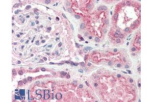 ABIN190757 (5µg/ml) staining of paraffin embedded Human Kidney. (OGG1 Antikörper  (Internal Region))