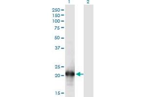 Western Blot analysis of HN1L expression in transfected 293T cell line by HN1L monoclonal antibody (M05), clone 1G8.