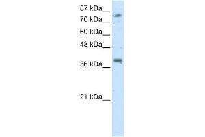 WB Suggested Anti-TSC22D2 Antibody Titration:  2. (TSC22D2 Antikörper  (C-Term))