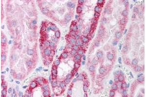 Human Kidney (formalin-fixed, paraffin-embedded) stained with POLR2B antibody ABIN214136 at 5 ug/ml followed by biotinylated goat anti-rabbit IgG secondary antibody ABIN481713, alkaline phosphatase-streptavidin and chromogen. (POLR2B Antikörper  (AA 805-854))