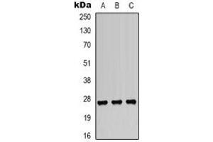 Western blot analysis of HSP27 (pS82) expression in A549 (A), HepG2 (B), K562 (C) whole cell lysates. (HSP27 Antikörper  (pSer82))