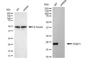 Western blotting analysis using PEBP1 antibody (ABIN7799790). (Rekombinanter PEBP1 Antikörper)