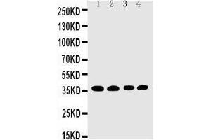 Western Blotting (WB) image for anti-Eukaryotic Translation Initiation Factor 2 Subunit 1 (EIF2S1) (AA 123-137), (Middle Region) antibody (ABIN3044058)