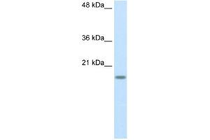 WB Suggested Anti-RPS14 Antibody Titration:  2. (RPS14 Antikörper  (Middle Region))
