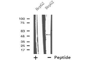 Western blot analysis of extracts from HepG2 cells, using IL13RA2 antibody. (IL13RA2 Antikörper  (C-Term))