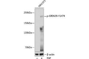 Western blot analysis of extracts of various cell lines, using Phospho-GRIN2B-Y1474 pAb (ABIN6135230, ABIN6136094, ABIN6136095 and ABIN6225667) at 1:1000 dilution. (GRIN2B Antikörper  (pTyr1474))