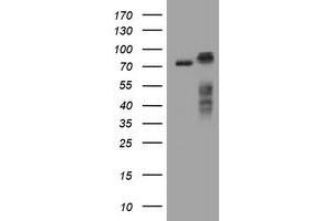Image no. 1 for anti-Receptor (TNFRSF)-Interacting serine-threonine Kinase 1 (RIPK1) (AA 133-422) antibody (ABIN1490911) (RIPK1 Antikörper  (AA 133-422))