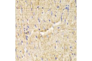 Immunohistochemistry of paraffin-embedded Mouse heart using PDLIM5 antibody at dilution of 1:100 (x400 lens). (PDLIM5 Antikörper)