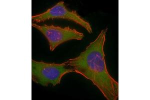 Immunofluorescent analysis of 4 % paraformaldehyde-fixed, 0. (PLEC Antikörper  (AA 4241-4275))