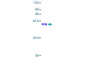 RPS20 Protein (AA 1-119) (GST tag)