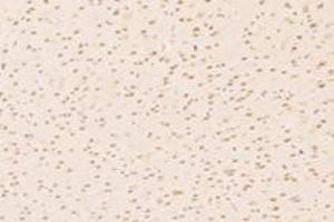 Immunohistochemistry (Paraffin-embedded Sections) (IHC (p)) image for anti-Zinc Finger Protein 154 (ZNF154) antibody (ABIN7076261)