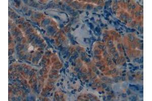 Figure. (MMP12 Antikörper  (AA 290-469))