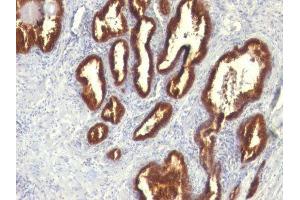 Image no. 1 for anti-Keratin 18 (KRT18) antibody (ABIN6179389) (Cytokeratin 18 Antikörper)