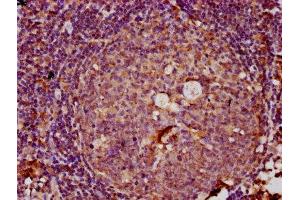 IHC image of ABIN7151049 diluted at 1:100 and staining in paraffin-embedded human tonsil tissue performed on a Leica BondTM system.