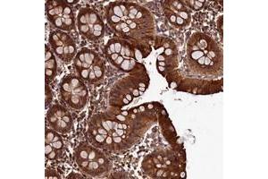 Immunohistochemical staining of human colon with LCMT2 polyclonal antibody  shows strong cytoplasmic positivity in glandular cells at 1:50-1:200 dilution. (LCMT2 Antikörper)