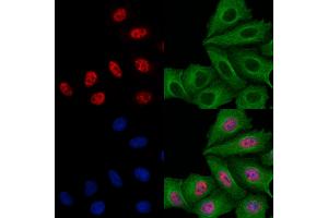 ABIN6258622 and ABIN6273497 staining Hela cells by IF/ICC. (SIVA1 Antikörper  (Internal Region))