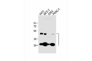 All lanes : Anti-CTSD Antibody at 1:1000 dilution Lane 1: A431 whole cell lysate Lane 2: MCF-7 whole cell lysate Lane 3: K562 whole cell lysate Lane 4: NC-1 whole cell lysate Lysates/proteins at 20 μg per lane.