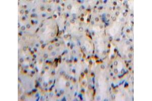 Used in DAB staining on fromalin fixed paraffin-embedded Kidney tissue (Dual Specificity Phosphatase 3 (DUSP3) (AA 2-185) Antikörper)