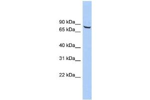 WB Suggested Anti-ACCN4 Antibody Titration: 0. (ACCN4 Antikörper  (Middle Region))