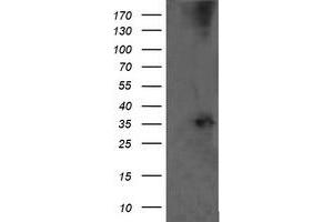 Western Blotting (WB) image for anti-T-cell surface glycoprotein CD1c (CD1C) antibody (ABIN2670667) (CD1c Antikörper)