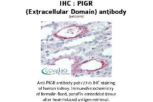 Image no. 1 for anti-Polymeric Immunoglobulin Receptor (PIGR) (Extracellular Domain) antibody (ABIN1738097) (PIGR Antikörper  (Extracellular Domain))