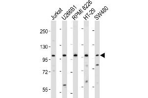 All lanes : Anti-NLRP6 Antibody (N-term) at 1:2000 dilution Lane 1: Jurkat whole cell lysate Lane 2: U266B1 whole cell lysate Lane 3: RI 8226 whole cell lysate Lane 4: HT-29 whole cell lysate Lane 5: S whole cell lysate Lysates/proteins at 20 μg per lane. (NLRP6 Antikörper  (N-Term))