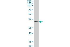 DKK1 monoclonal antibody (M01), clone 4D4. (DKK1 Antikörper  (AA 81-180))