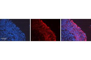 Immunohistochemistry (IHC) image for anti-PTK2 Protein tyrosine Kinase 2 (PTK2) (Middle Region) antibody (ABIN2791666)