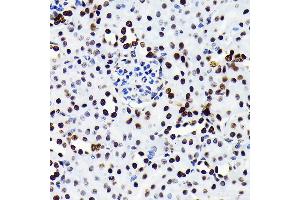 Immunohistochemistry of paraffin-embedded Mouse kidney using HMGB1 antibody (ABIN7267648) at dilution of 1:100 (40x lens). (HMGB1 Antikörper)