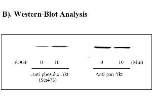 Image no. 3 for V-Akt Murine Thymoma Viral Oncogene Homolog 1 (AKT1) ELISA Kit (ABIN625233)