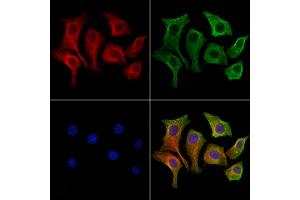 ABIN6257509 and ABIN6275598 staining HepG2 cells by IF/ICC.