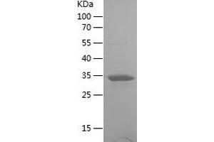 Western Blotting (WB) image for Ureidopropionase, beta (UPB1) (AA 289-384) protein (His-IF2DI Tag) (ABIN7125659) (UPB1 Protein (AA 289-384) (His-IF2DI Tag))