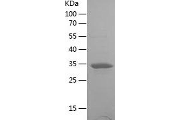 UPB1 Protein (AA 289-384) (His-IF2DI Tag)