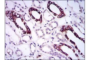 Immunohistochemistry (IHC) image for anti-Bone Morphogenetic Protein Receptor 1A (BMPR1A) (AA 179-378) antibody (ABIN1845272) (BMPR1A Antikörper  (AA 179-378))