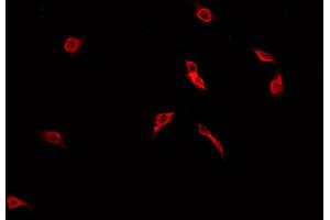 ABIN6269213 staining A549 cells by IF/ICC. (CDC25B Antikörper  (Internal Region))