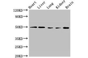 GPR22 anticorps  (AA 246-307)