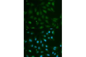 Immunofluorescence analysis of MCF-7 cells using ABO antibody (ABIN5970766).